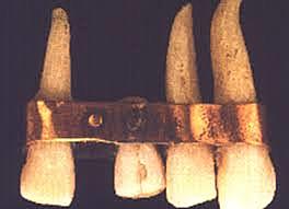 Inicios de la Odontología Restauradora