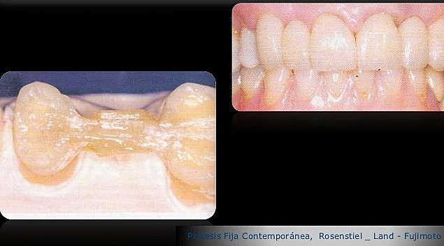 Composite Reforzado con Fibra
