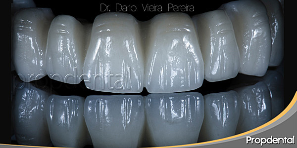 Técnica del doctor Pfaff