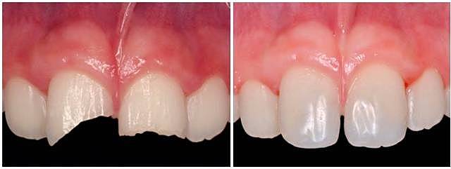 INVENTO DE COMPOSITES