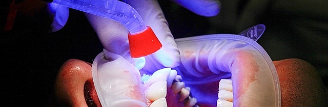 PRIMER COMPOSITE DE FOTOCURADO