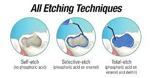 DESARROLLO DE GRABADO TOTAL (TOTAL-ETCH)