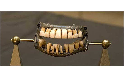 Alexis Duchateau.  Porcelana para dentadura