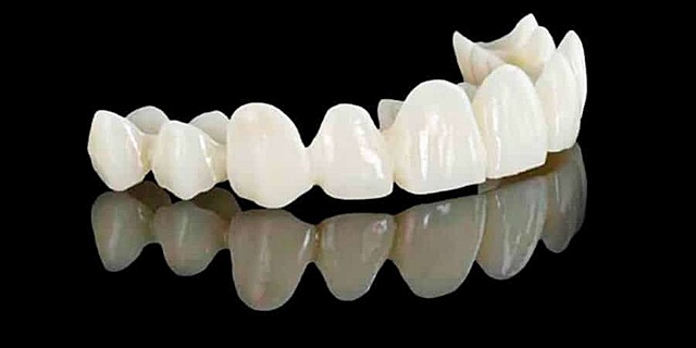 Primer uso de la porcelana para hacer una dentadura completa por Alexis Duchateau en 1774