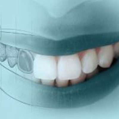 Timeline: Odontología Restauradora