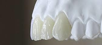 Introducción Cerámica