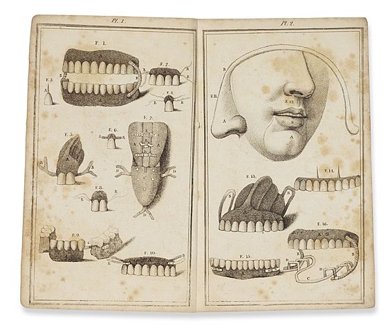 Primer Diente de Porcelana