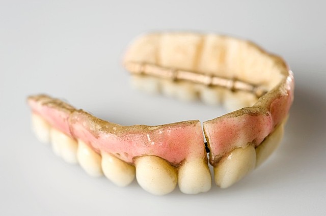 Dientes de Porcelana en Protesis