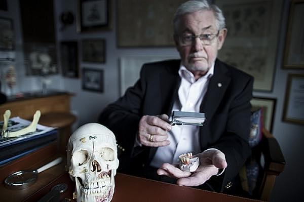 TÉCNICA PARA REALIZAR IMPLANTES DENTALES