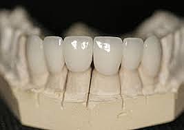 1999. Se introduce la zirconia In-Ceram