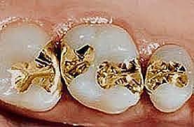 Lámina de oro cohesiva