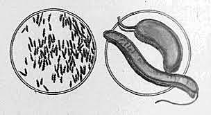 Descubrimiento del bacilo de Tuberculosis
