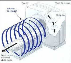 Escáner 6ta generación (TC espiral o helicoidal)
