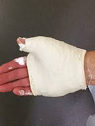 El primer cop que em trenco un dit