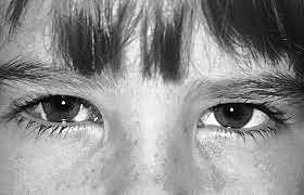 Kerato-conjuntivitis a Berlín