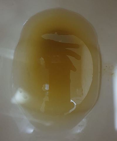 Reportó Dolor Abdominal