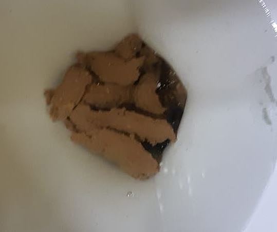 Reportó Dolor Abdominal