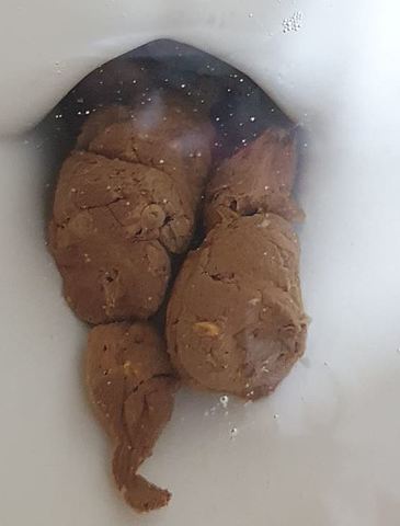 Reportó Dolor Abdominal