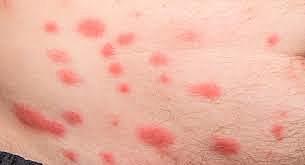 Acontecimiento Personal