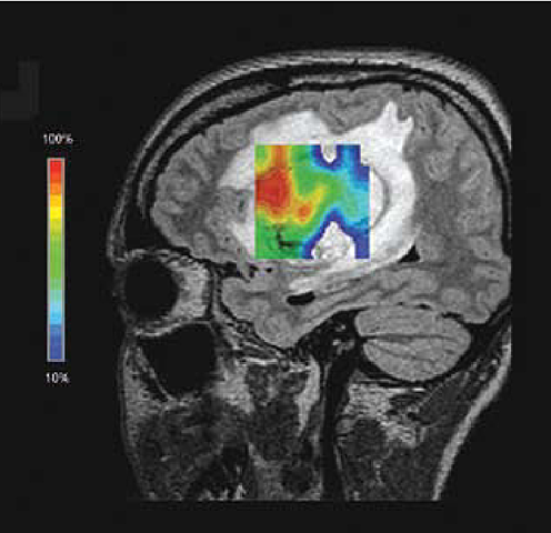 1975-periodo Contemporáneo