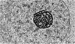 microscopio electrónico de transmisión (TEM)
