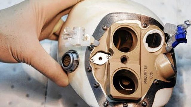 Primer trasplantament d'un cor artificial en un humà en l'hospital Georges Pompidou de París.