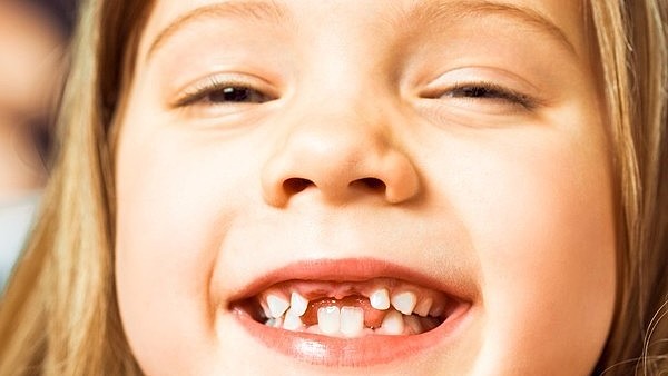 Em cau la primera dent