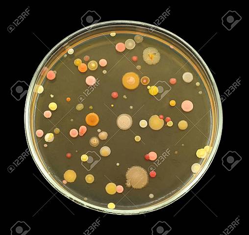 Robert Koch describe colonias bacterianas creciendo en rodajas de papa, medio gelatinoso y medio agarizado.