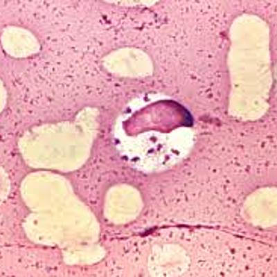 Timeline: Ciclos vida de protozoos y nematodos sanguíneos