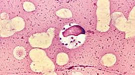 Timeline: Ciclos vida de protozoos y nematodos sanguíneos