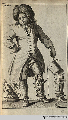 Prótesis por debajo de la rodilla