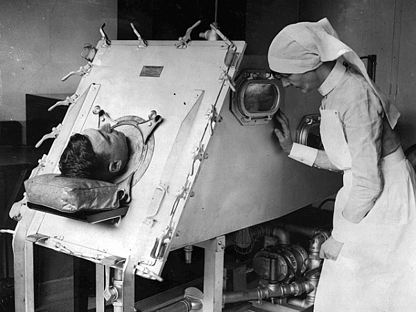 Invención del respirador artificial