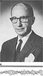 Invención del Electroencefalograma