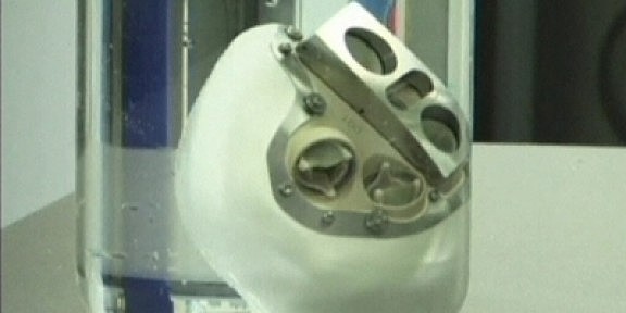 Transplantament de cor