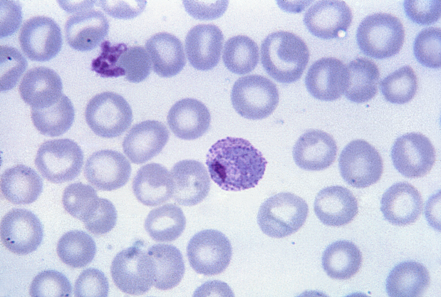 Plasmodium Vivax