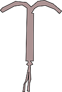 El dispositivo intrauterino o DIU