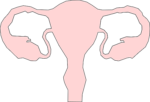 La Ligadura de trompas en las mujeres