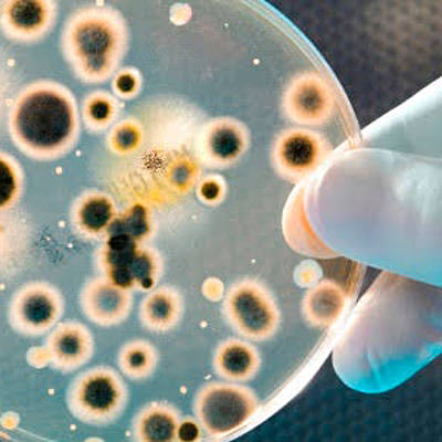 Timeline: Historia de la microbiologia