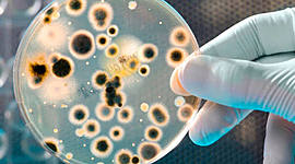 Timeline: Historia de la microbiologia