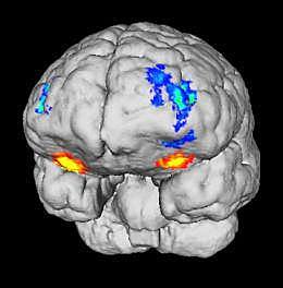 1978 Neuropsicología de orientación psicológica