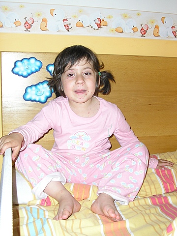 VAIG TENIR LA VARICEL·LA