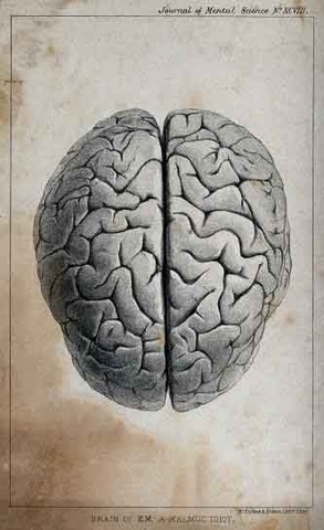 Psychiatrists view of Insanity