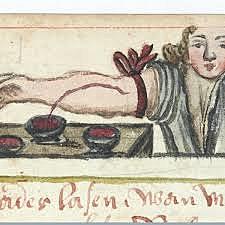 Egyptians used bloodletting to try to cure diseases