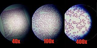 Anton Van Leeuwenhoek looked at blood cells under a microscope