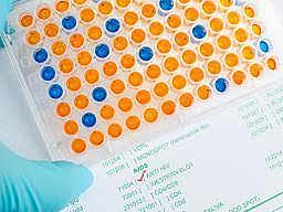 ELISA test development for disease screening