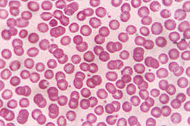 Anton van Leeuwenhoek Viewed Blood Cells Under A Microscope