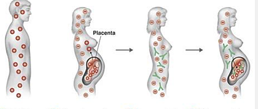Karl Landateiner discovered the Rh protein
