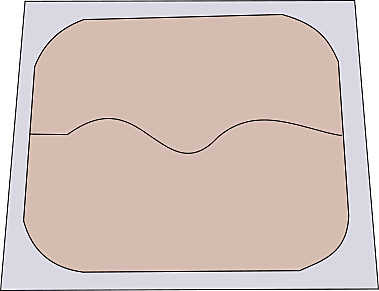 Parche anticonceptivo