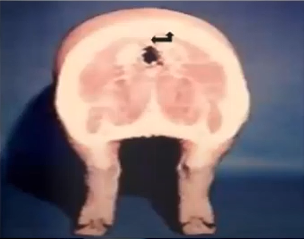 Contenido de grasa en la canal porcina