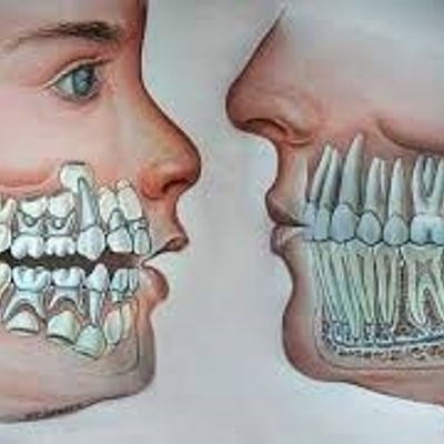 Timeline: Desarrollo de la Dentición